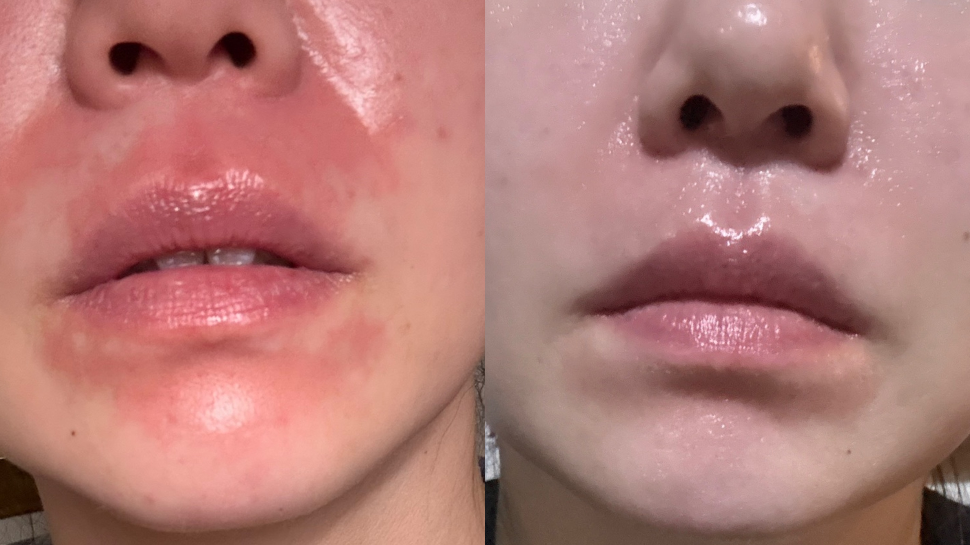 피부하라 photo 5