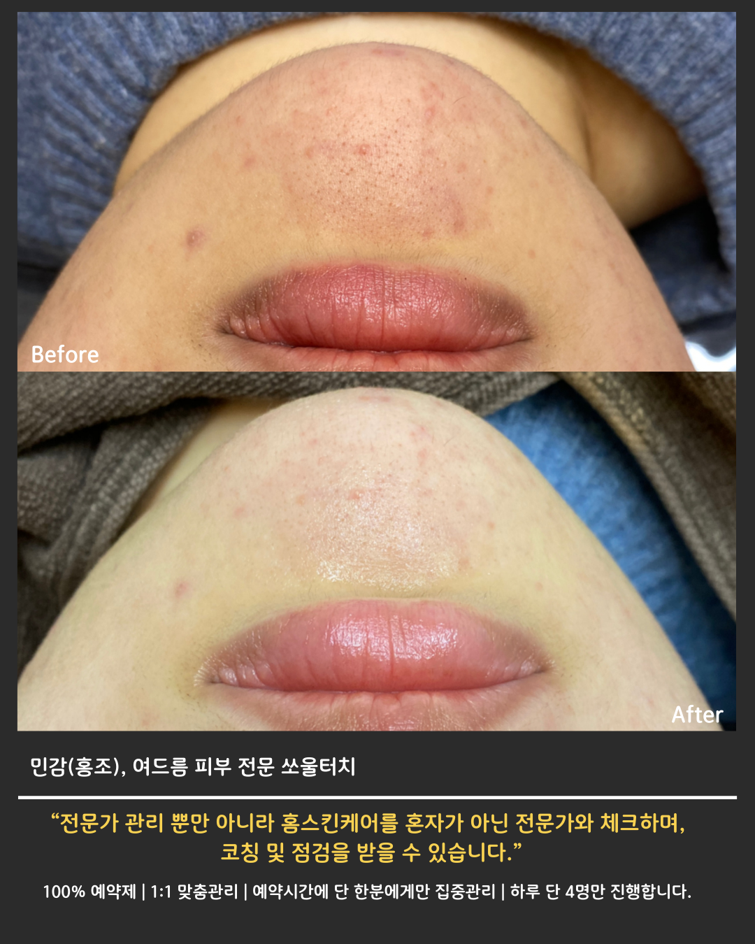 쏘울터치 대표 이미지