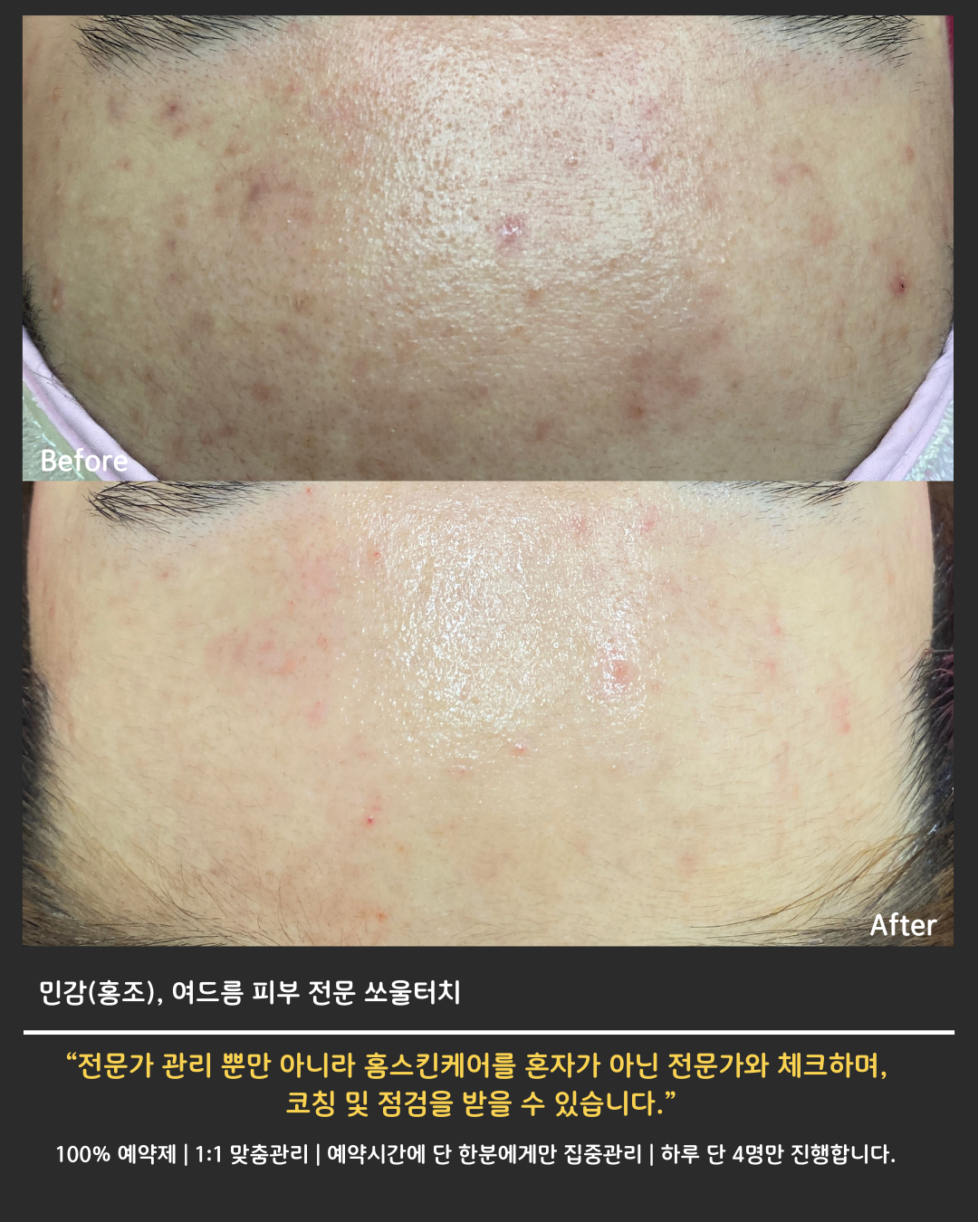 쏘울터치 대표 이미지