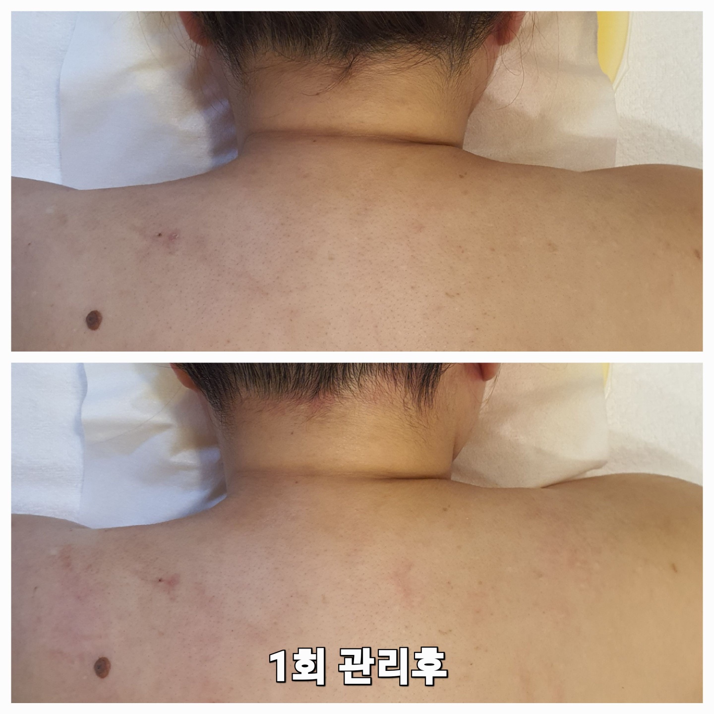 리뉴 케어 photo 4