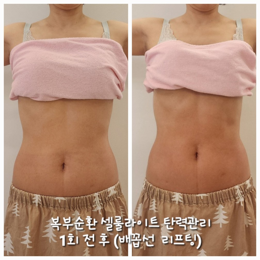 스킨핏헤드스파 대표 이미지