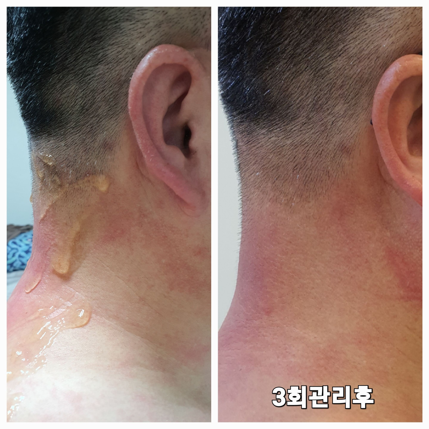 리뉴 케어 photo 5