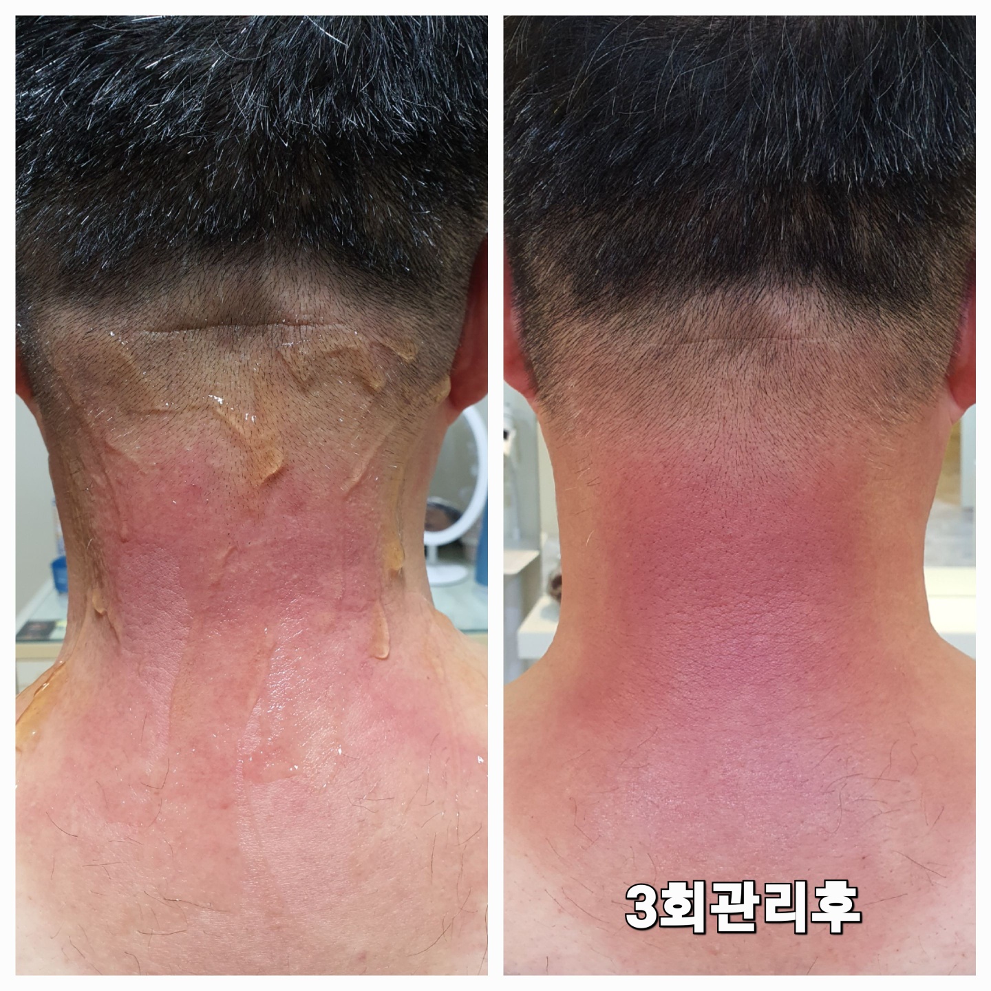 리뉴 케어 photo 6