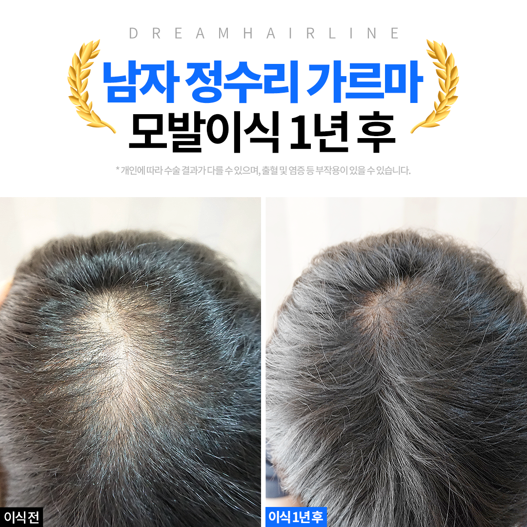 드림헤어라인의원 대표 이미지