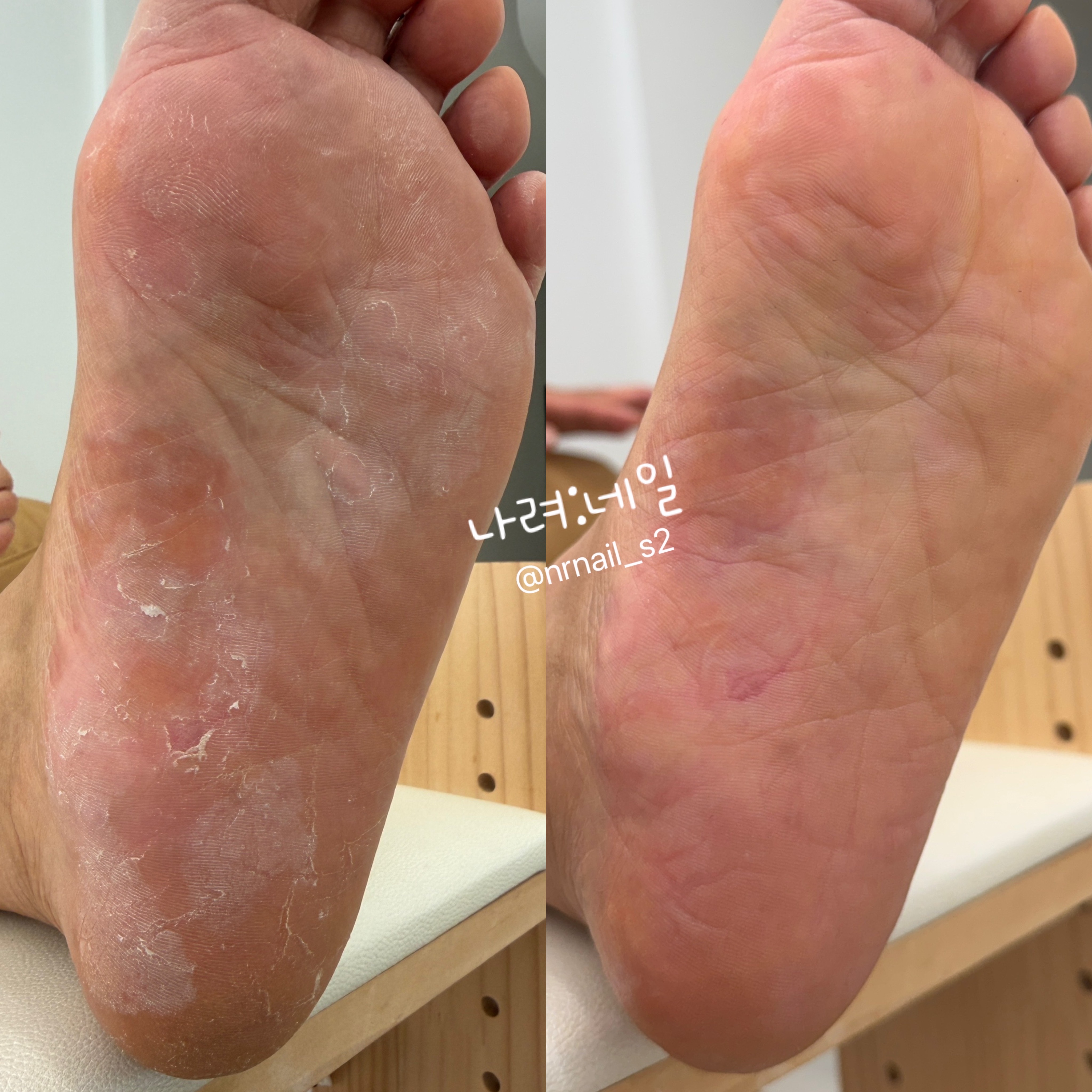 나려: 네일 대표 이미지
