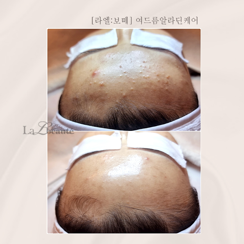 라엘보떼 대표 이미지