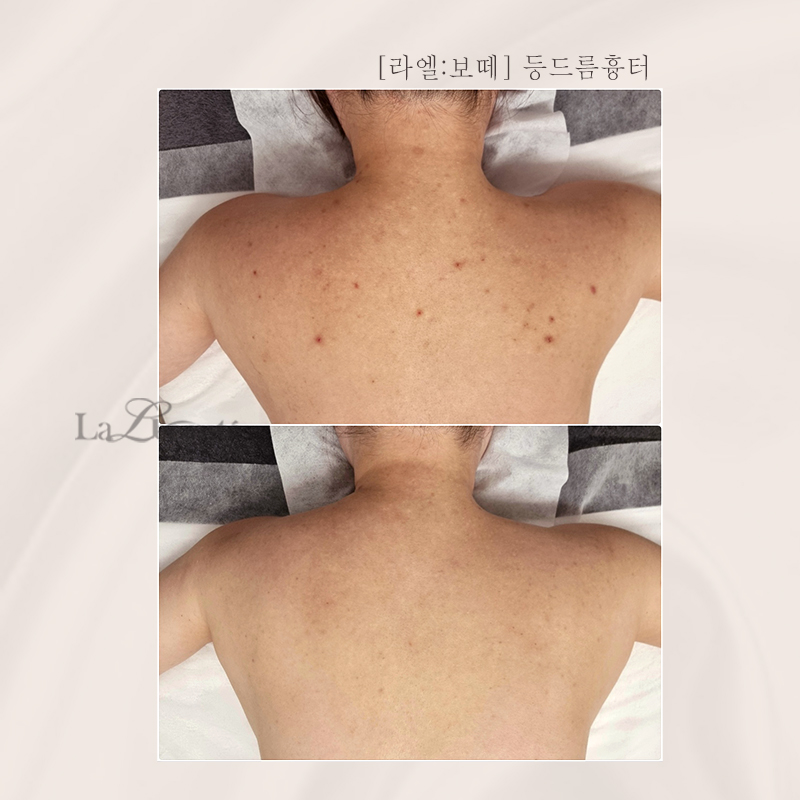 라엘보떼 대표 이미지