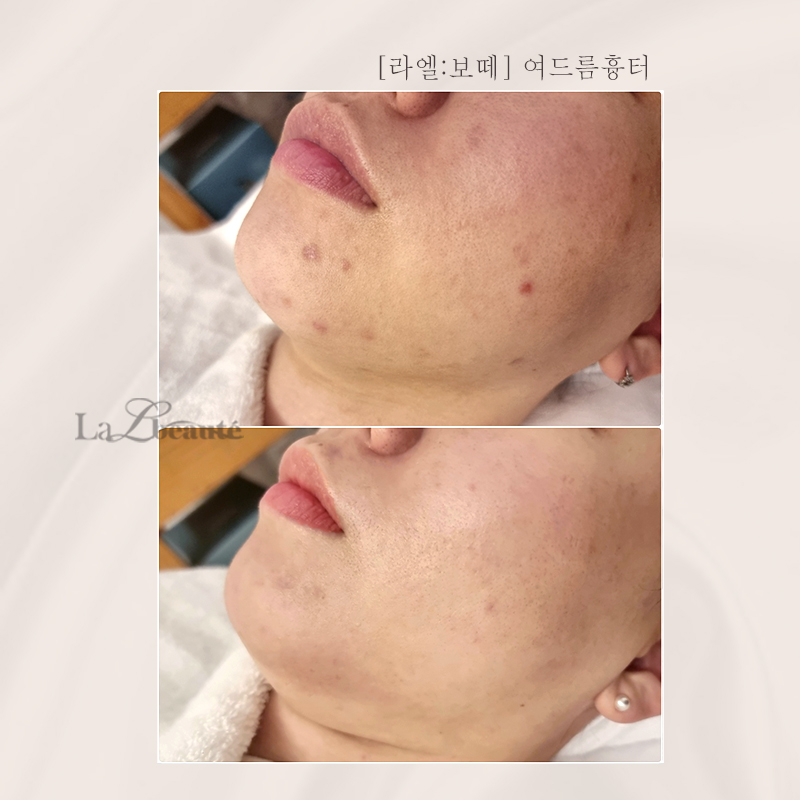 라엘보떼 대표 이미지