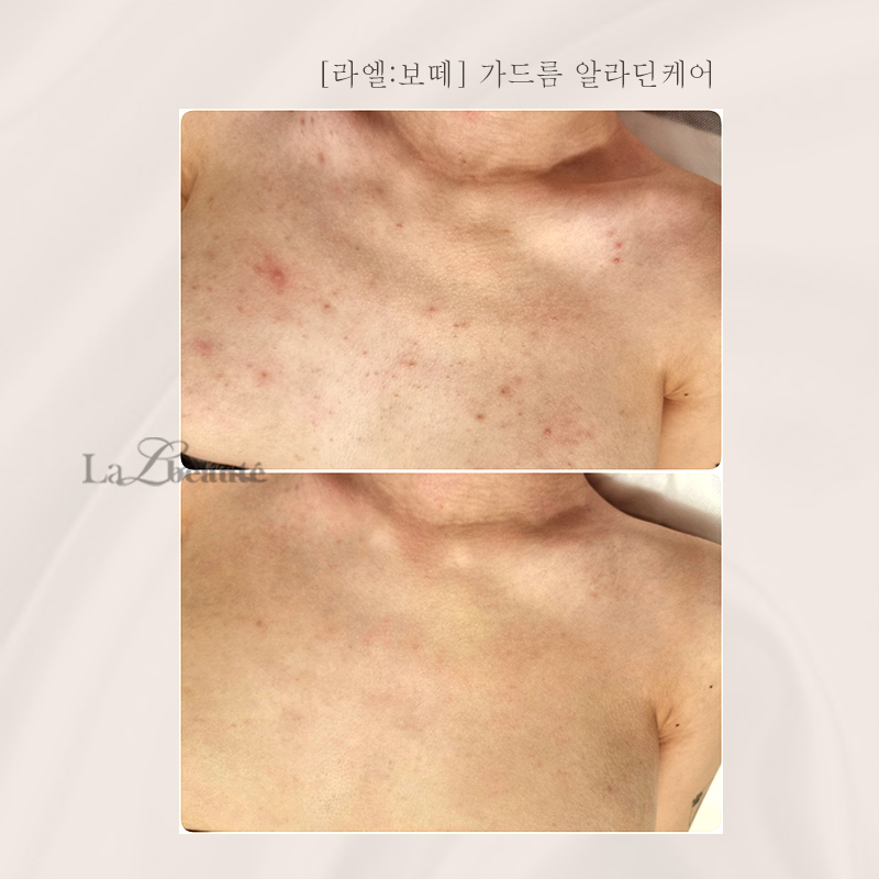 라엘보떼 대표 이미지