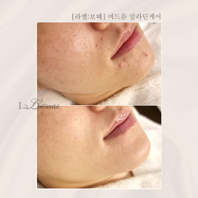 라엘보떼 대표 이미지