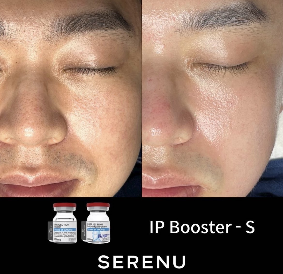 세레누 이천점 대표 이미지