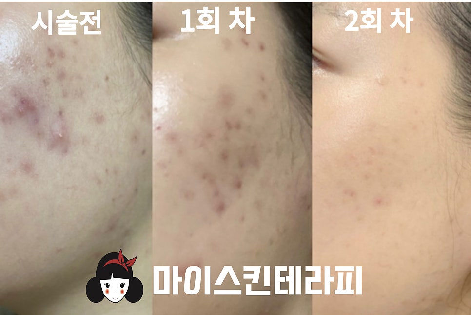 마이스킨테라피 대표 이미지