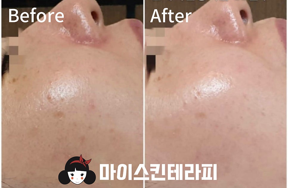 마이스킨테라피 대표 이미지