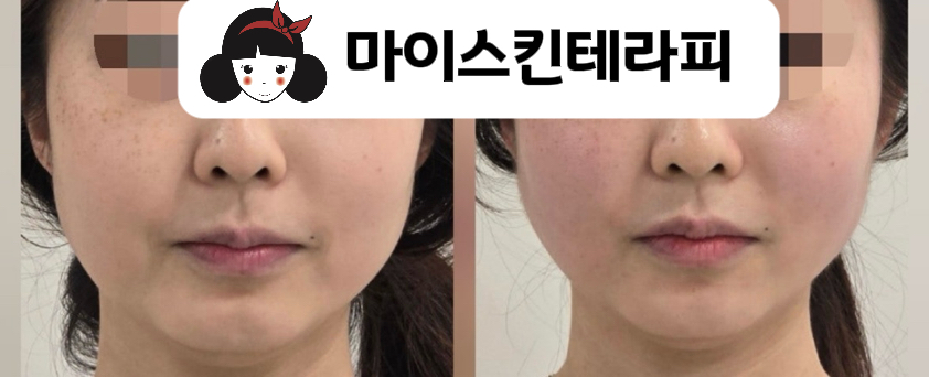 마이스킨테라피 수유점 대표 이미지