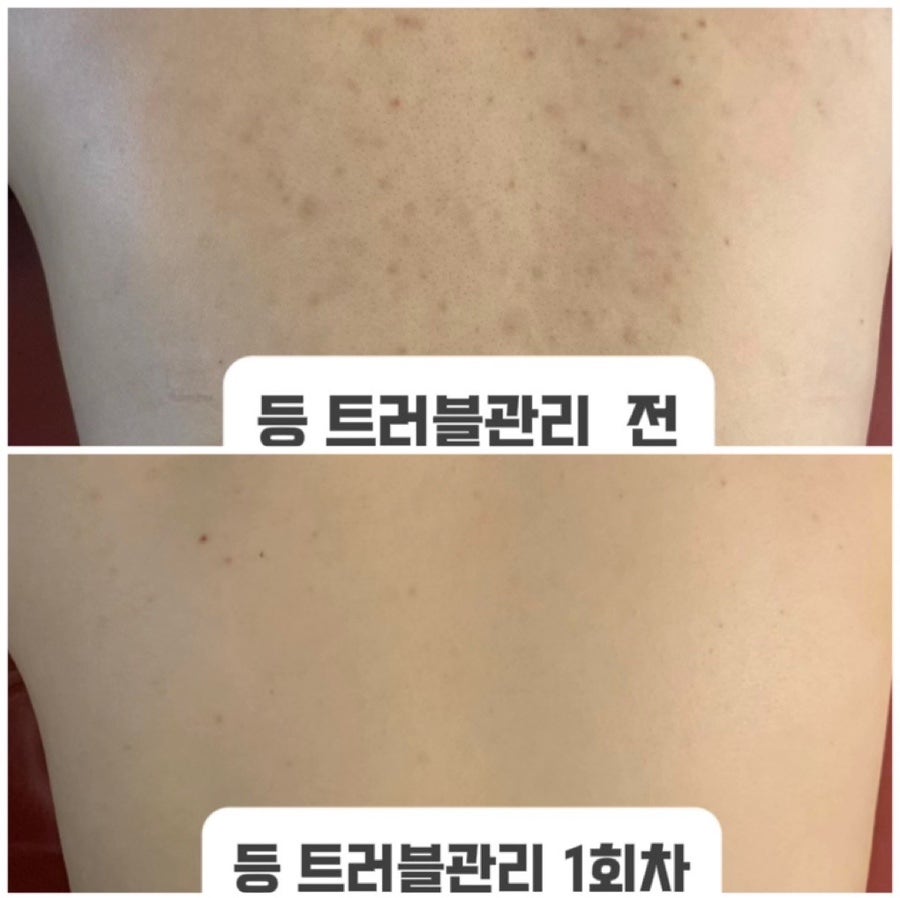 마이스킨테라피 수유점 대표 이미지