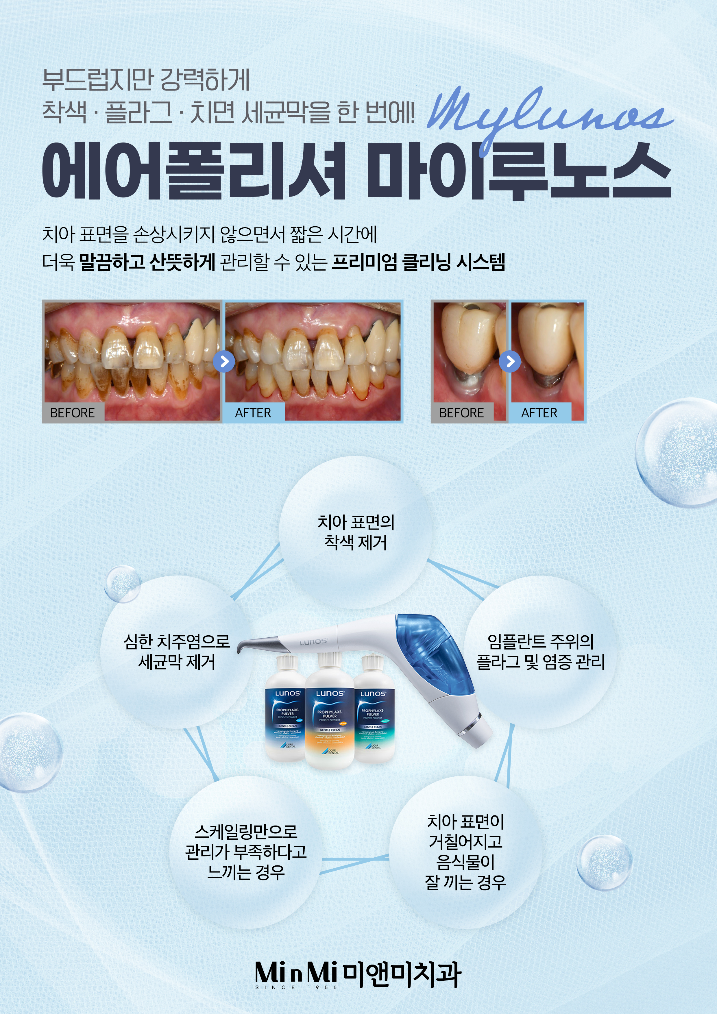미앤미치과 이미지