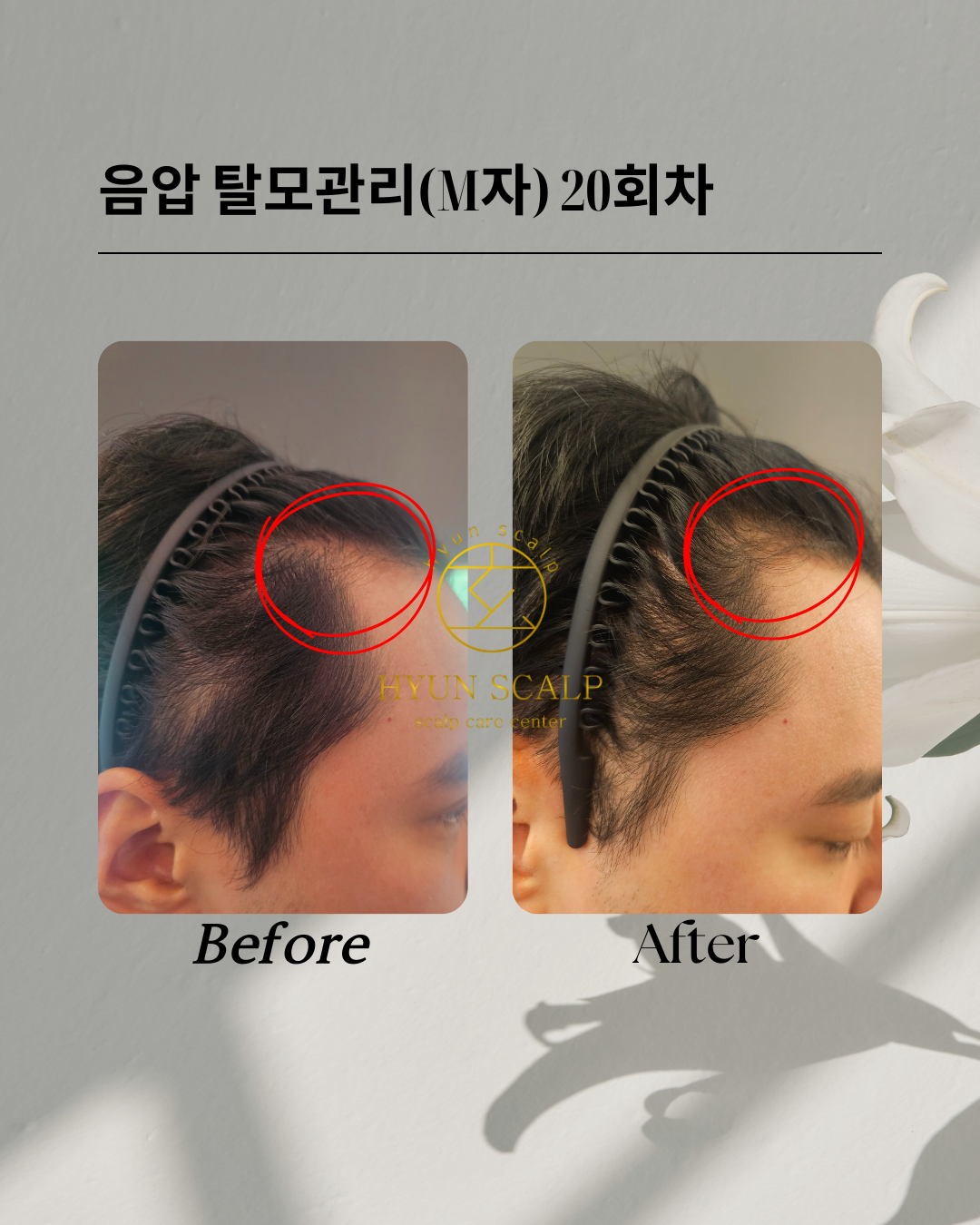 현스칼프 이대점 대표 이미지