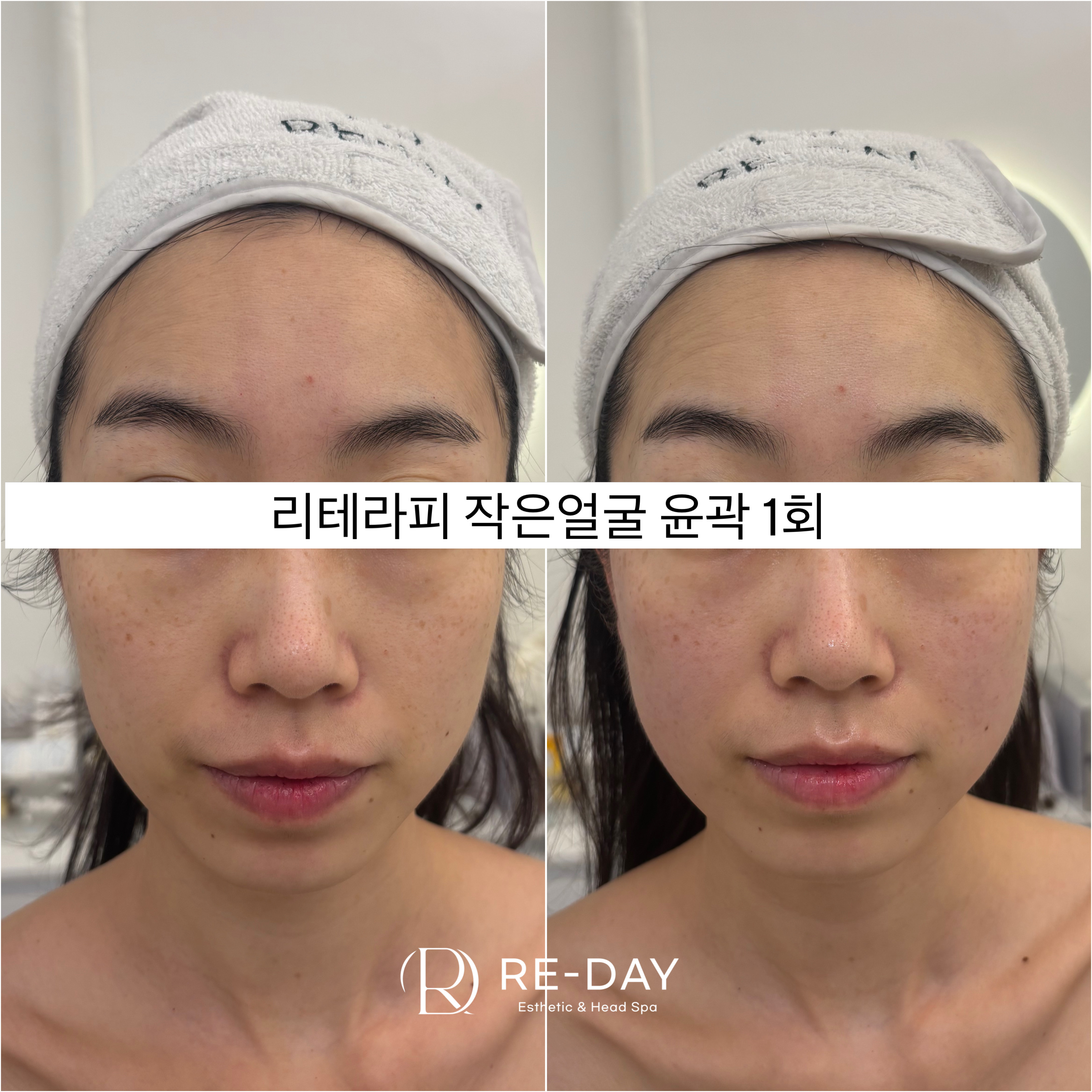 리데이에스테틱 대표 이미지