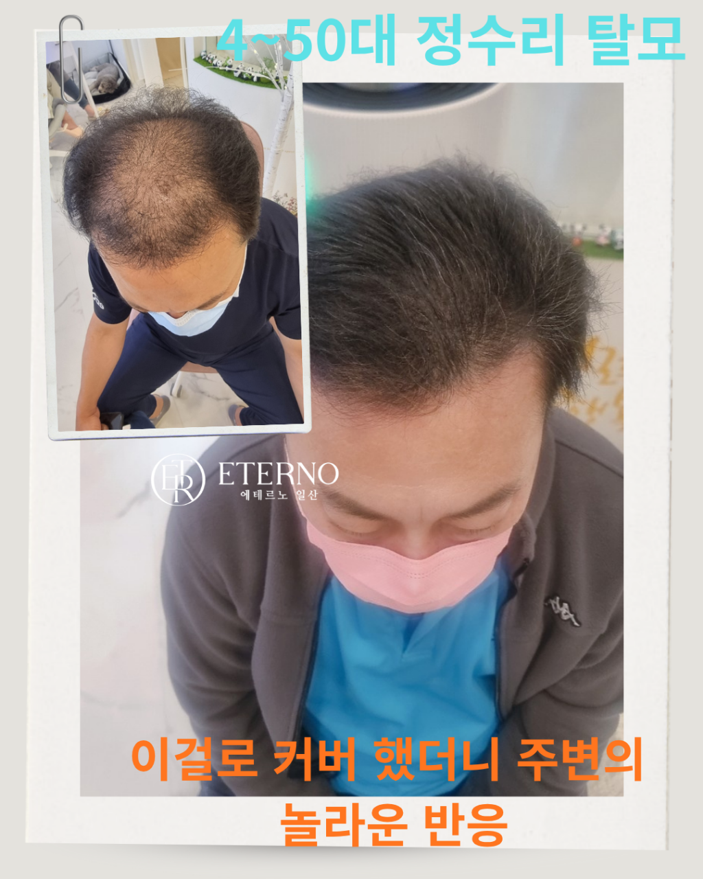 에테르노 대표 이미지