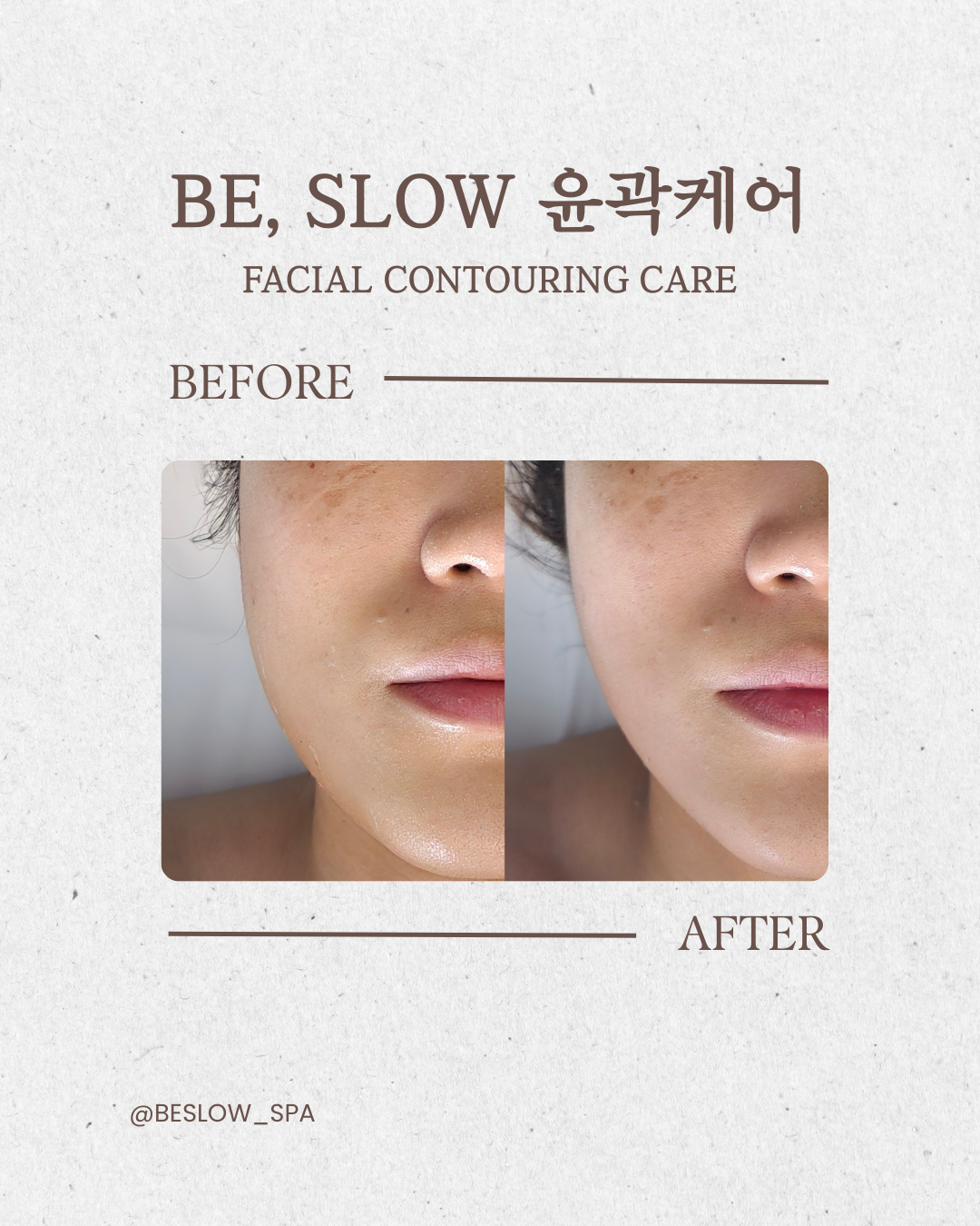 비슬로 스파 photo 2