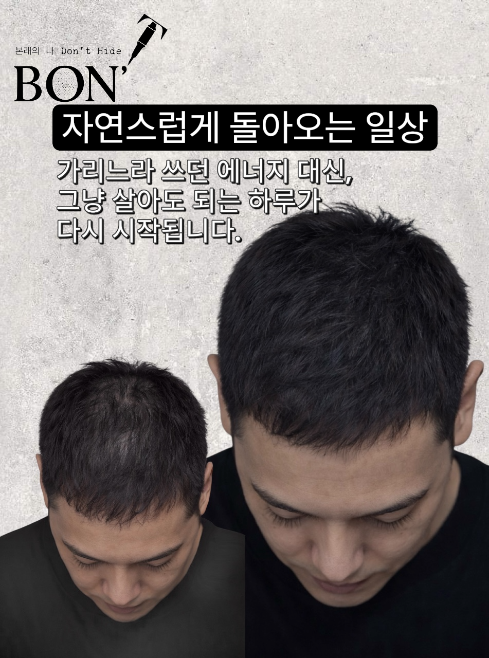 본트SMP 대표 이미지