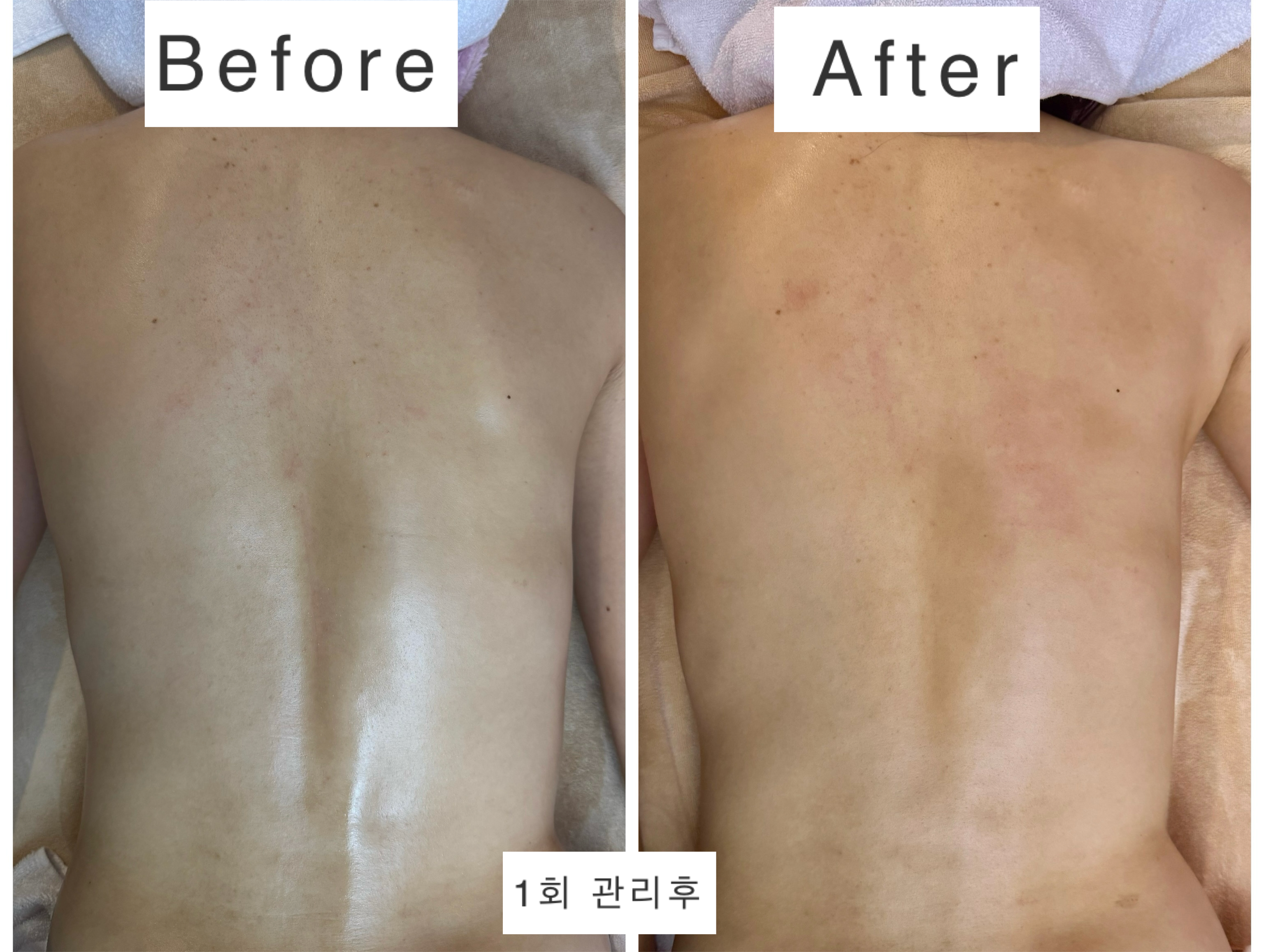 온하다에스테틱 첨단점 photo 8