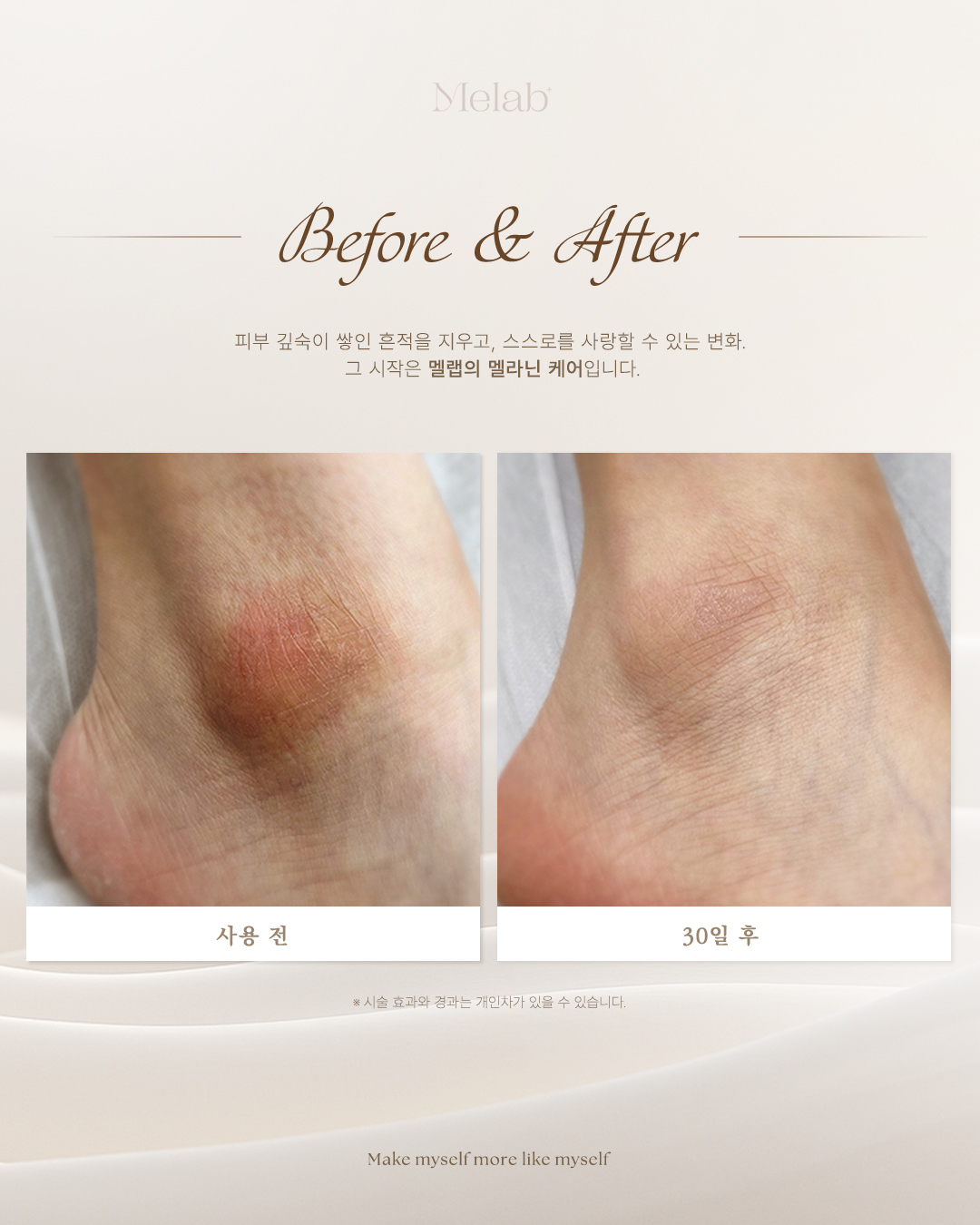 리포윅스 슈가링왁싱 대표 이미지