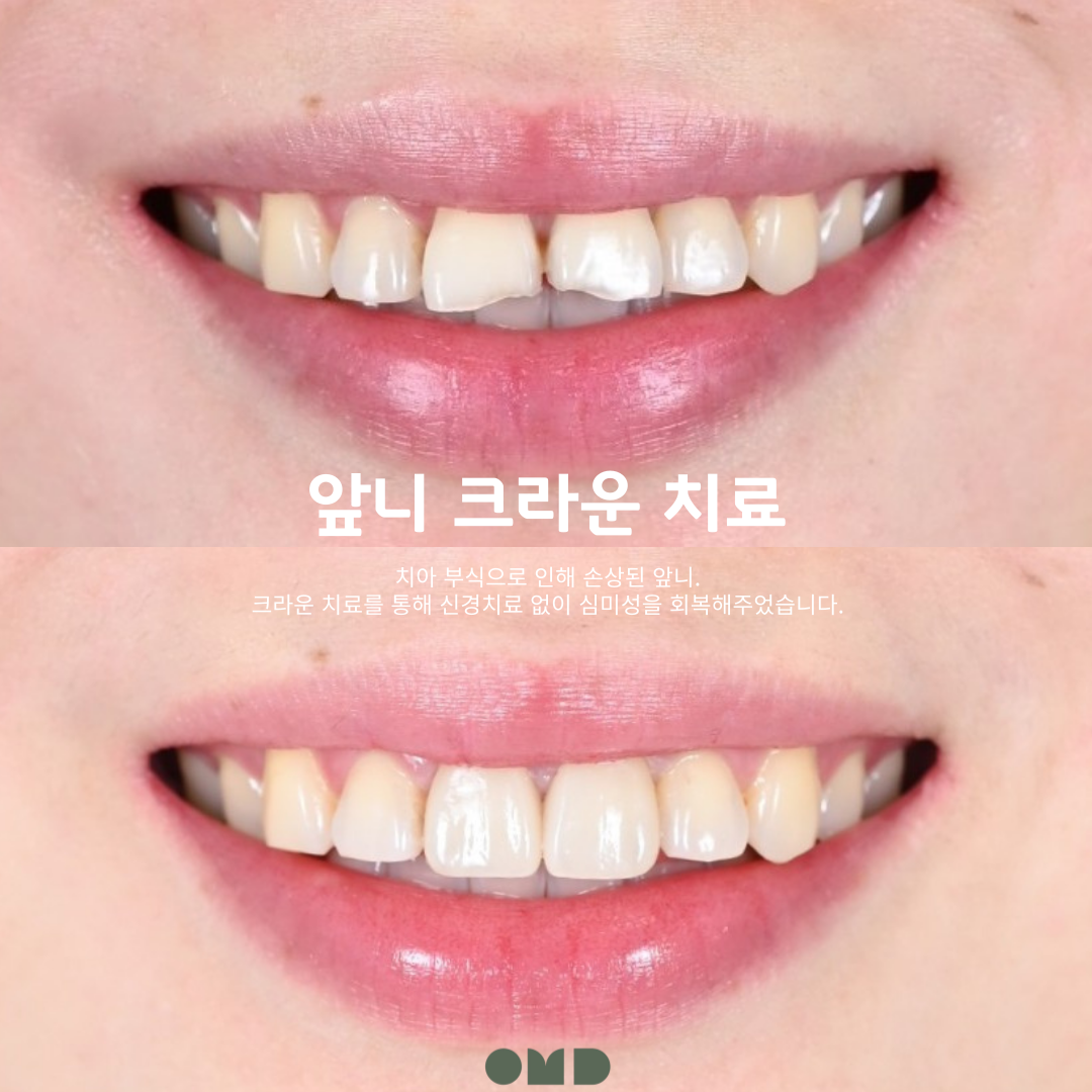 이보다치과의원 부천본원 대표 이미지