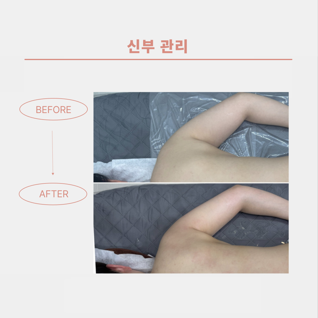벨루위드미 대표 이미지