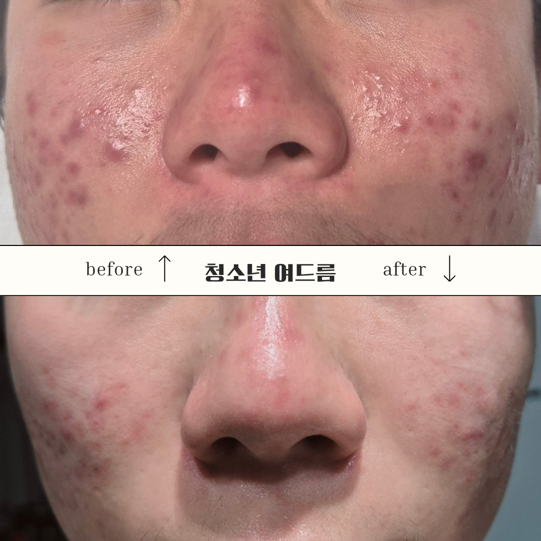 고원장모공세척 대표 이미지