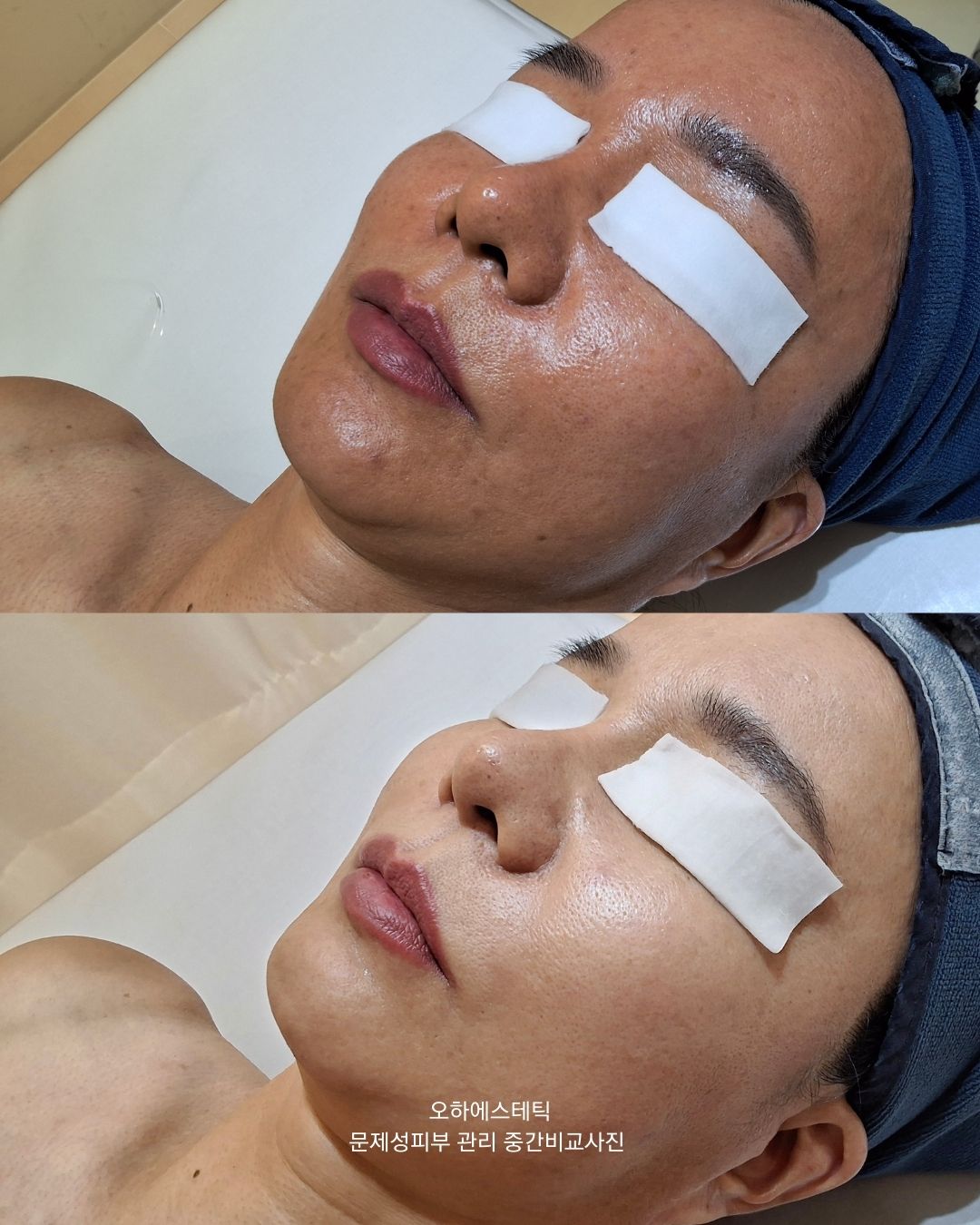 오하에스테틱 대표 이미지