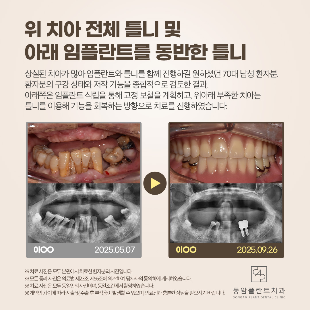 동암플란트치과 대표 이미지