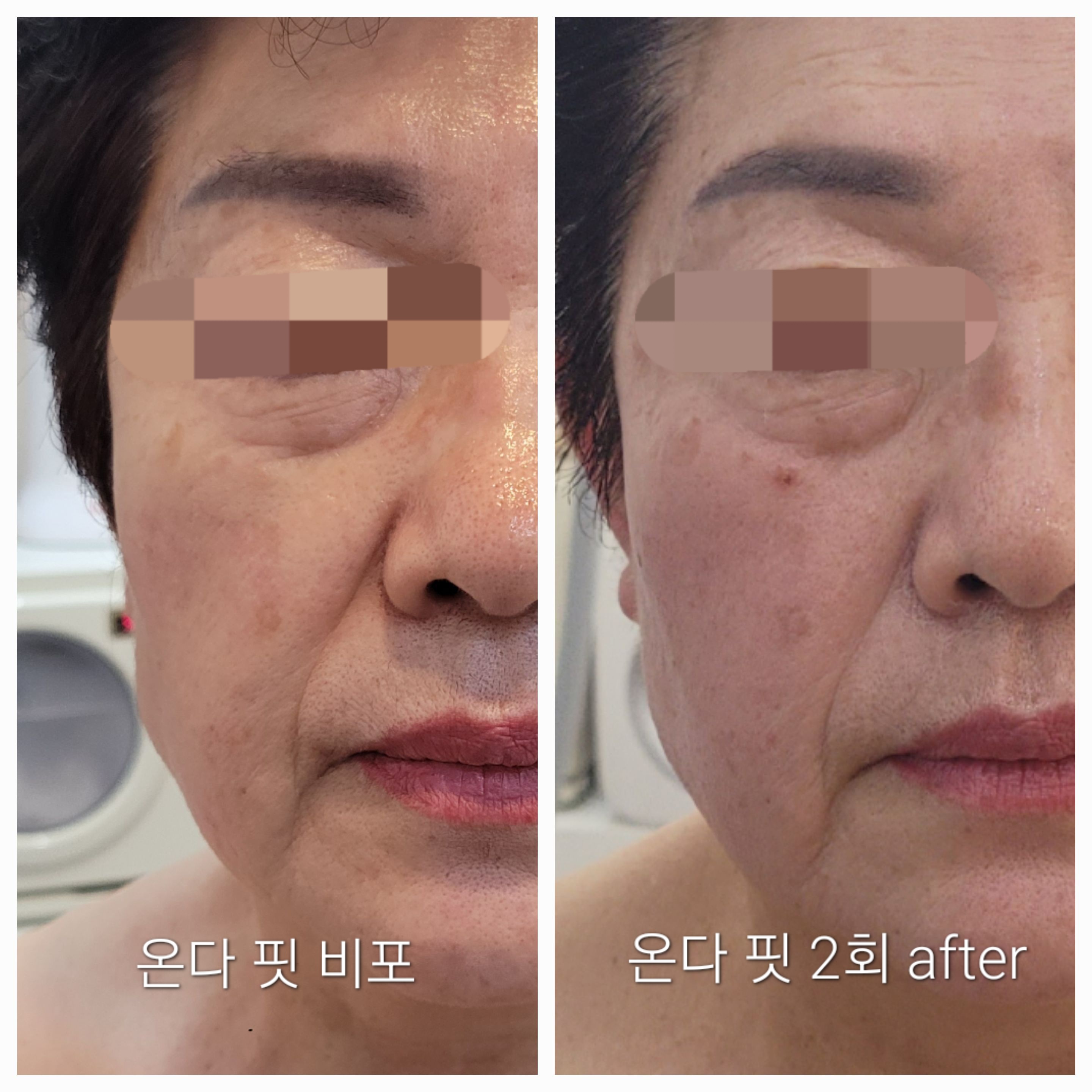 블레싱스킨케어 대표 이미지