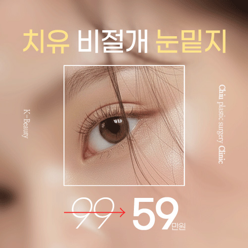 치유성형외과 대표 이미지