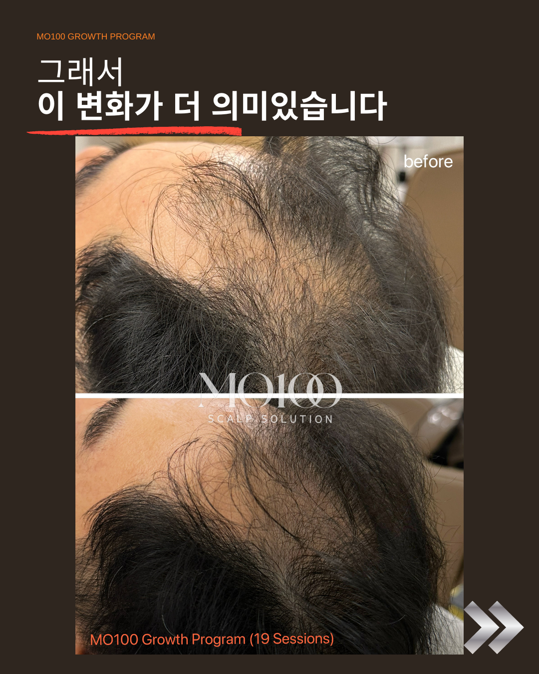 페이스디자인 대표 이미지
