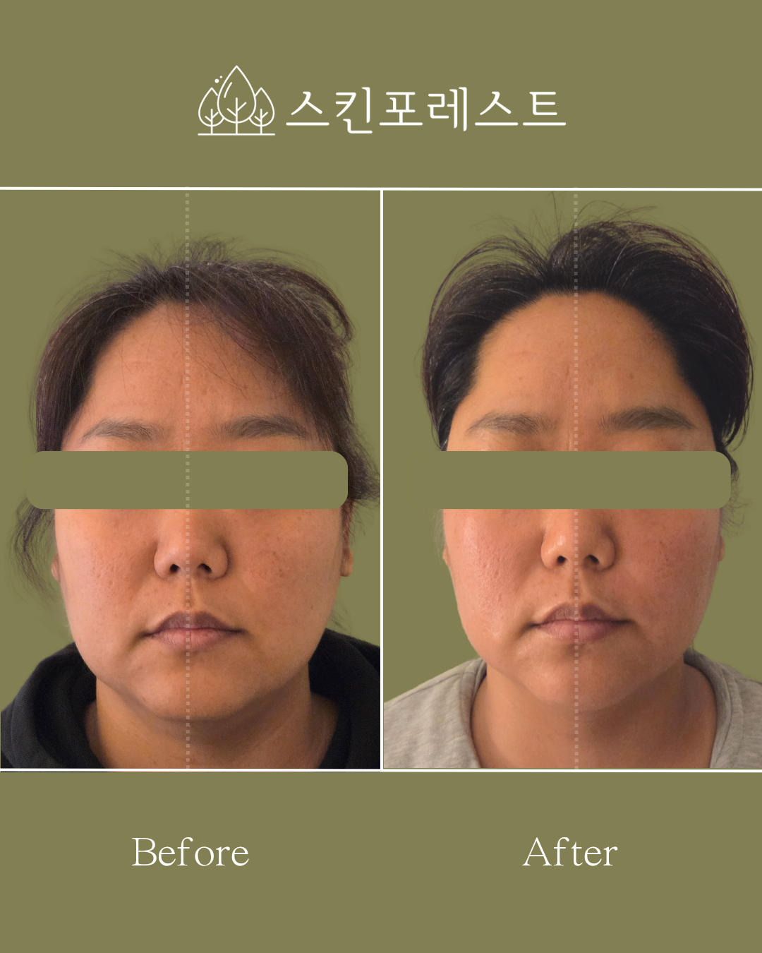 스킨포레스트 대표 이미지