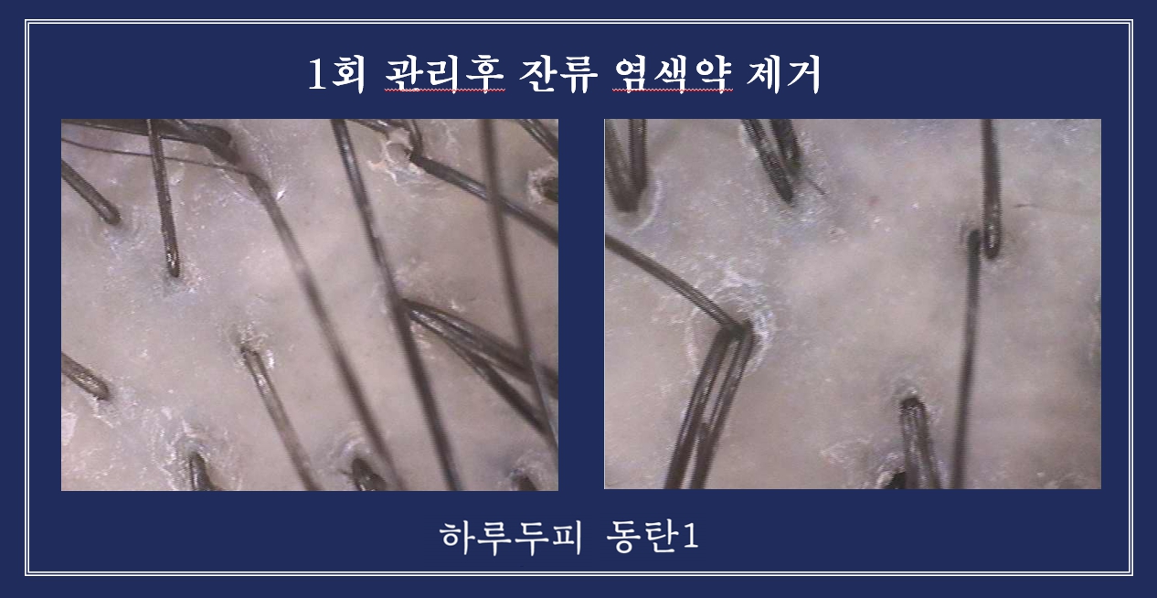 하루두피 동탄1점 대표 이미지