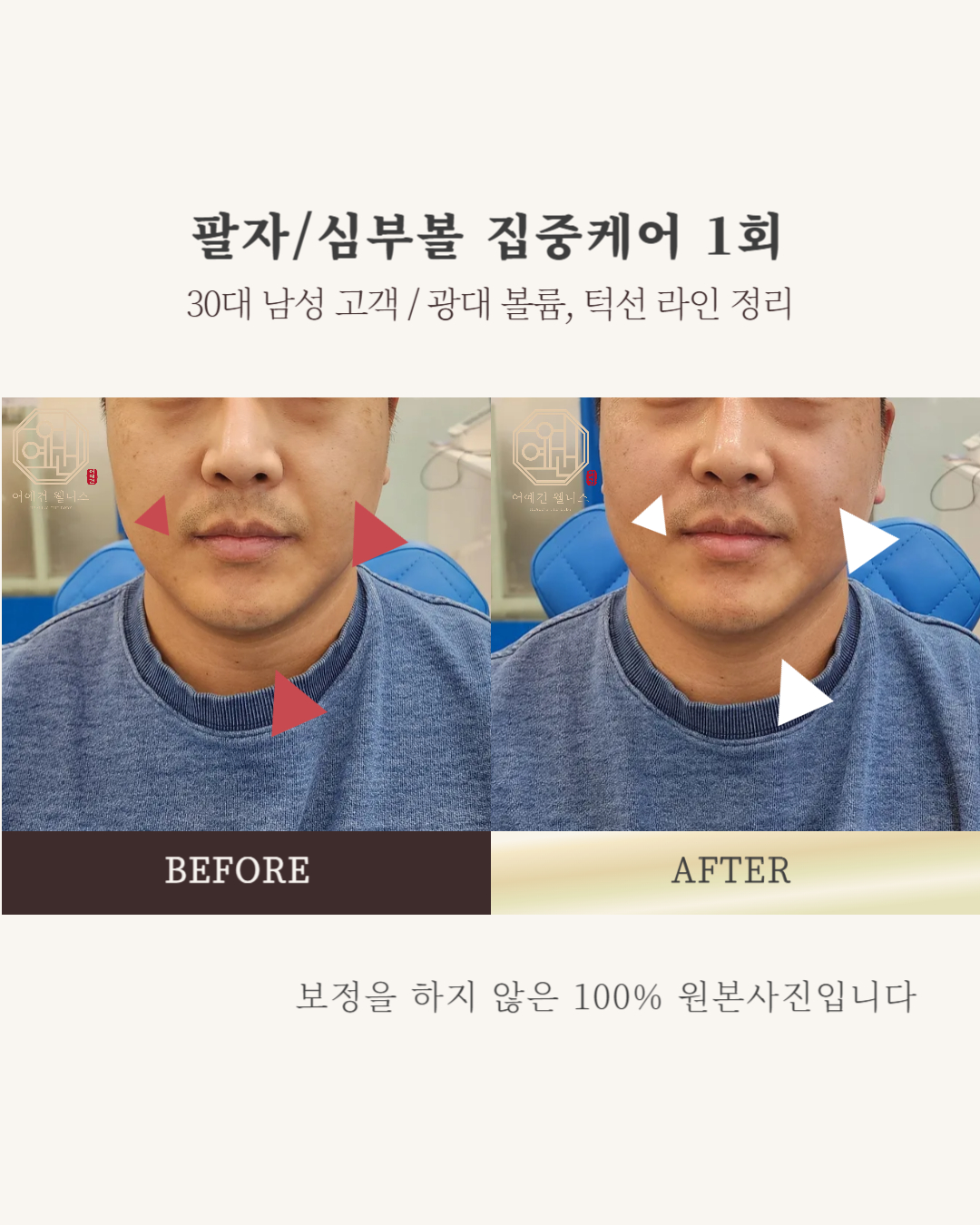 페이스컨디셔닝 대표 이미지