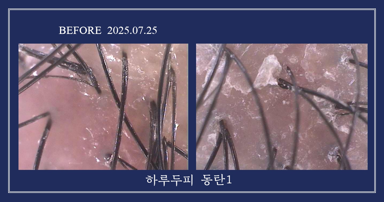 하루두피 동탄1점 대표 이미지