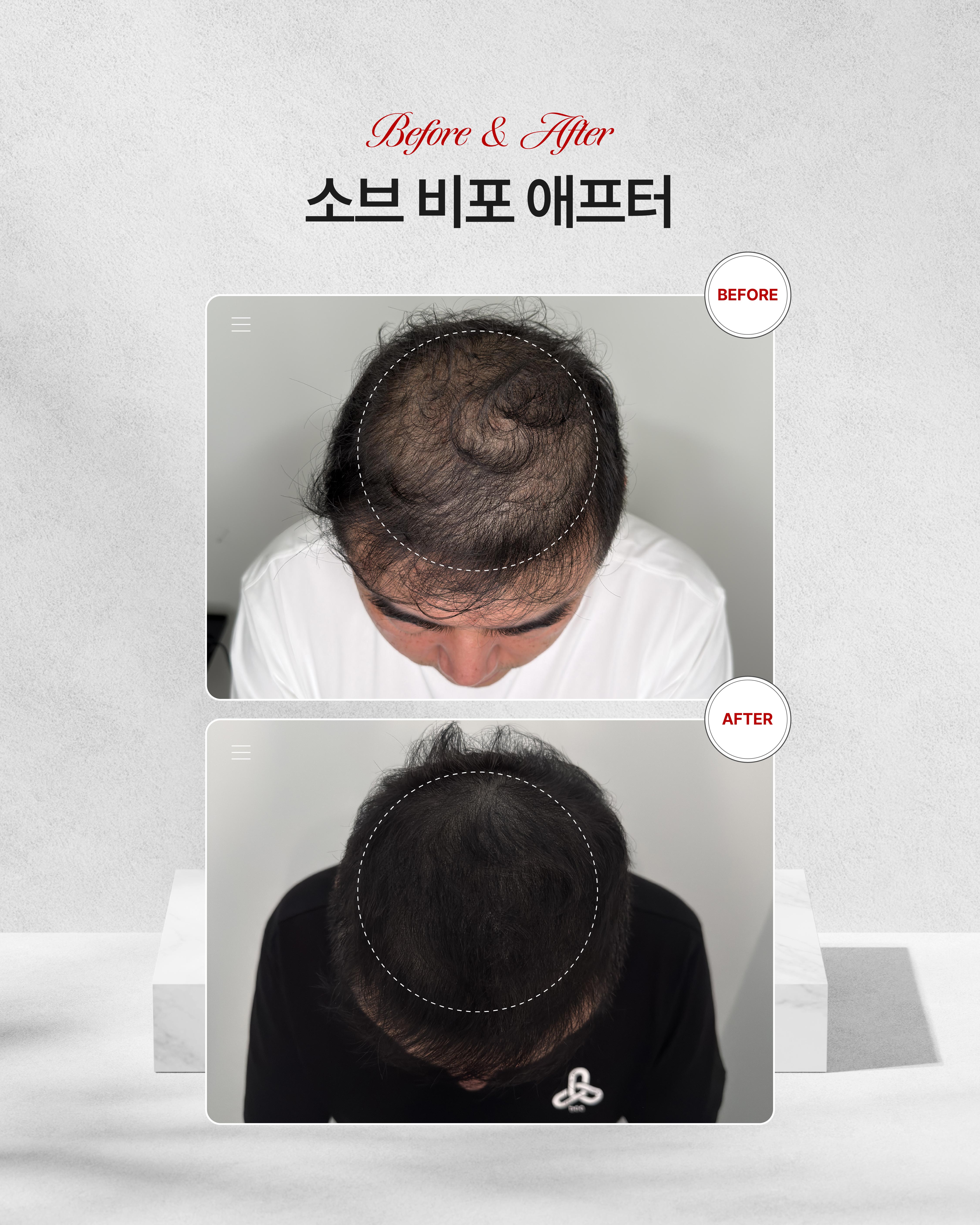 소브 대표 이미지