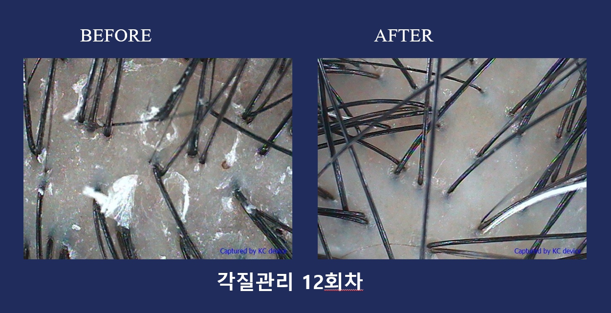하루두피 동탄1점 대표 이미지