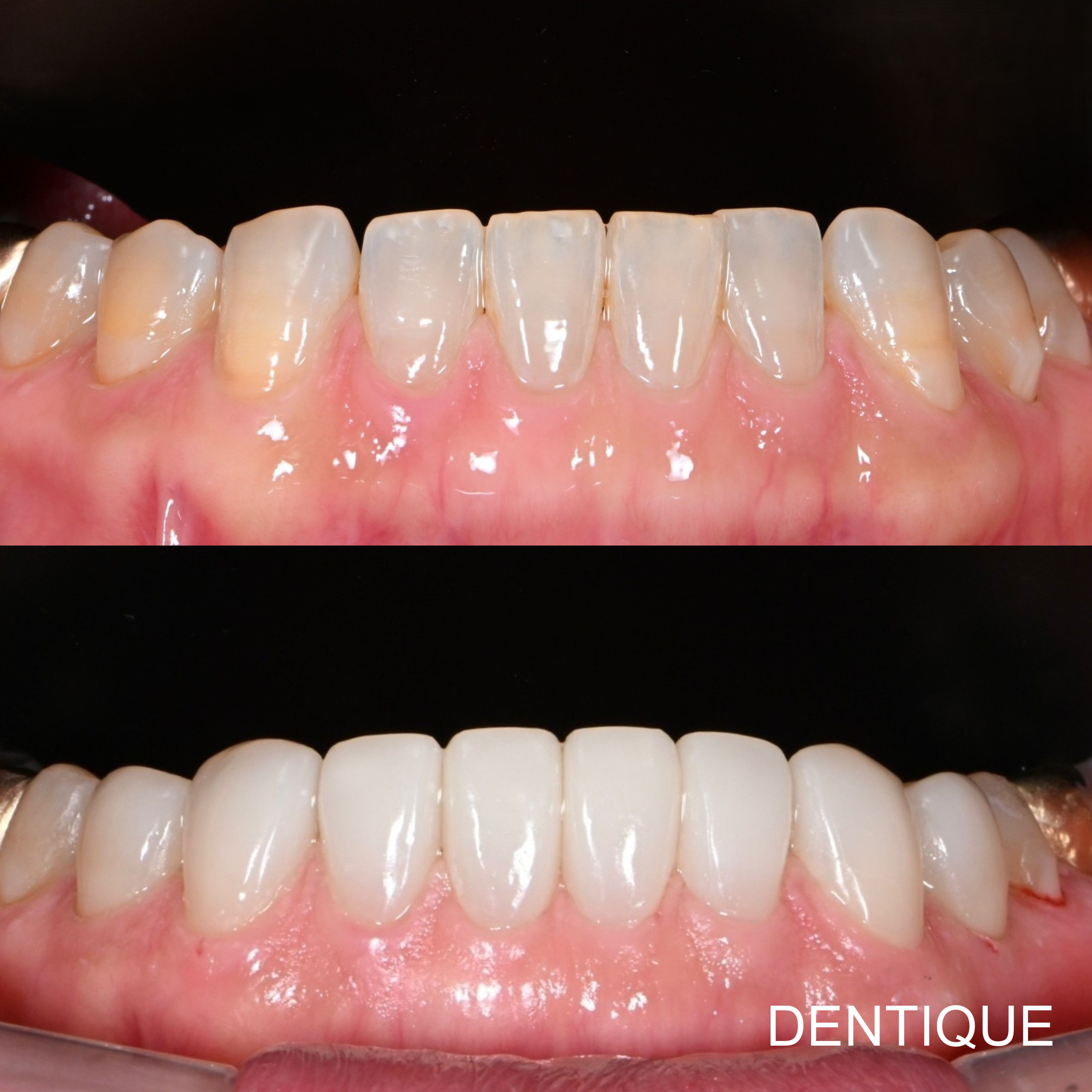 덴티크치과 대표 이미지