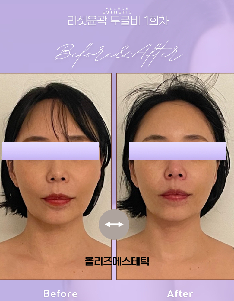 올리즈에스테틱