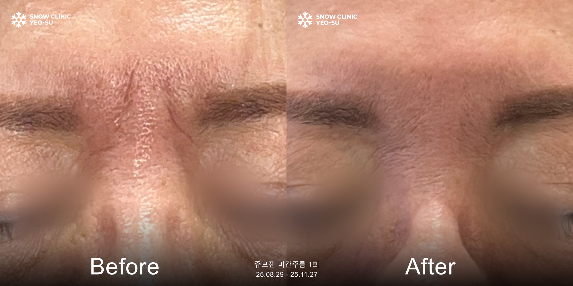 스노우의원 대표 이미지