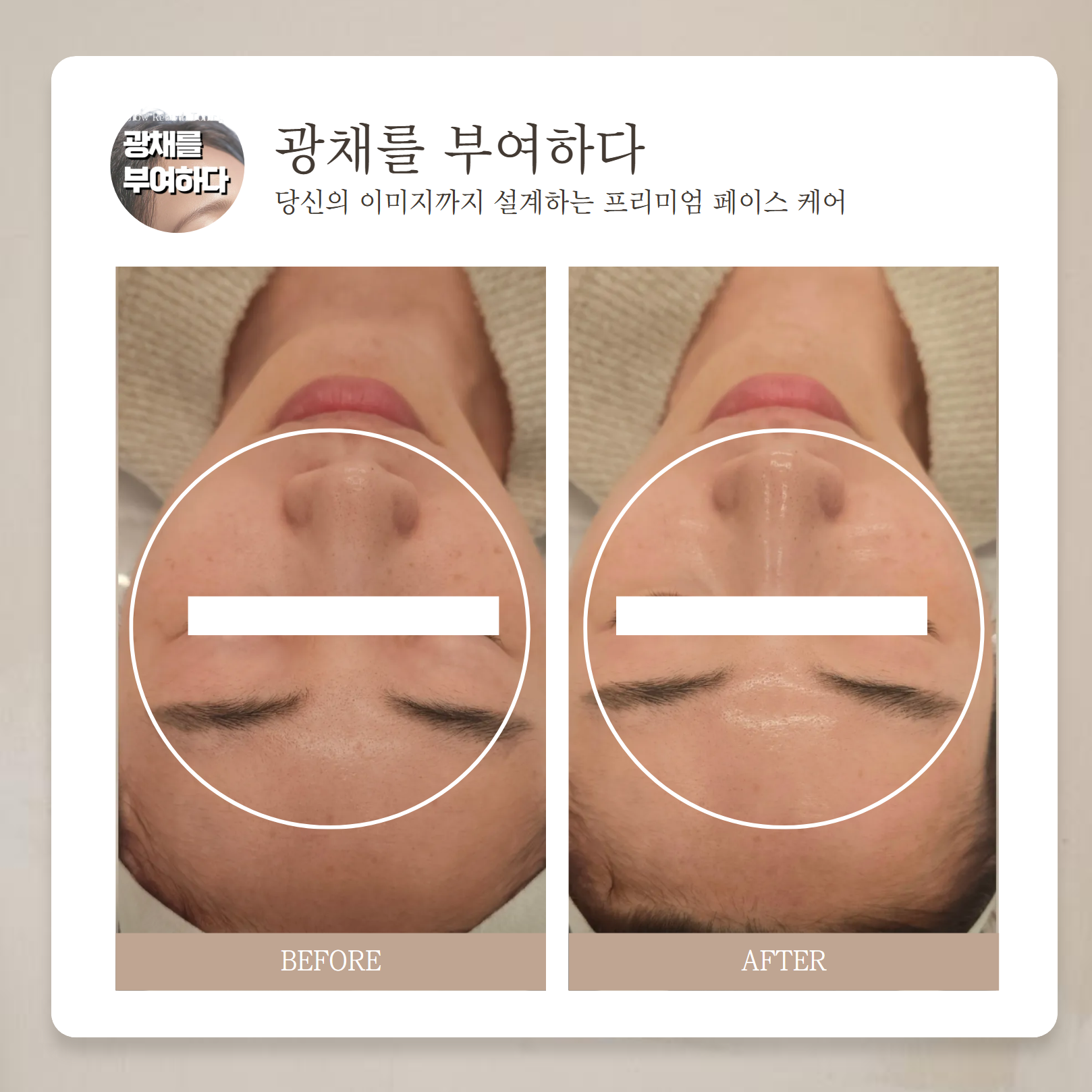 엘리에스테틱 대표 이미지