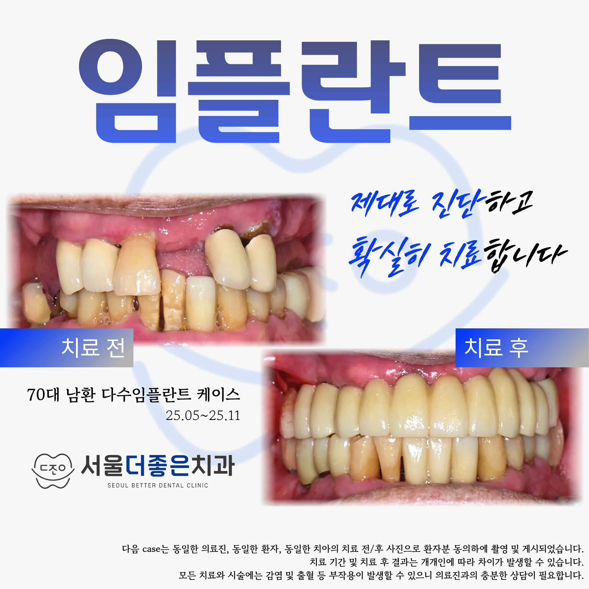 서울더좋은치과 대표 이미지
