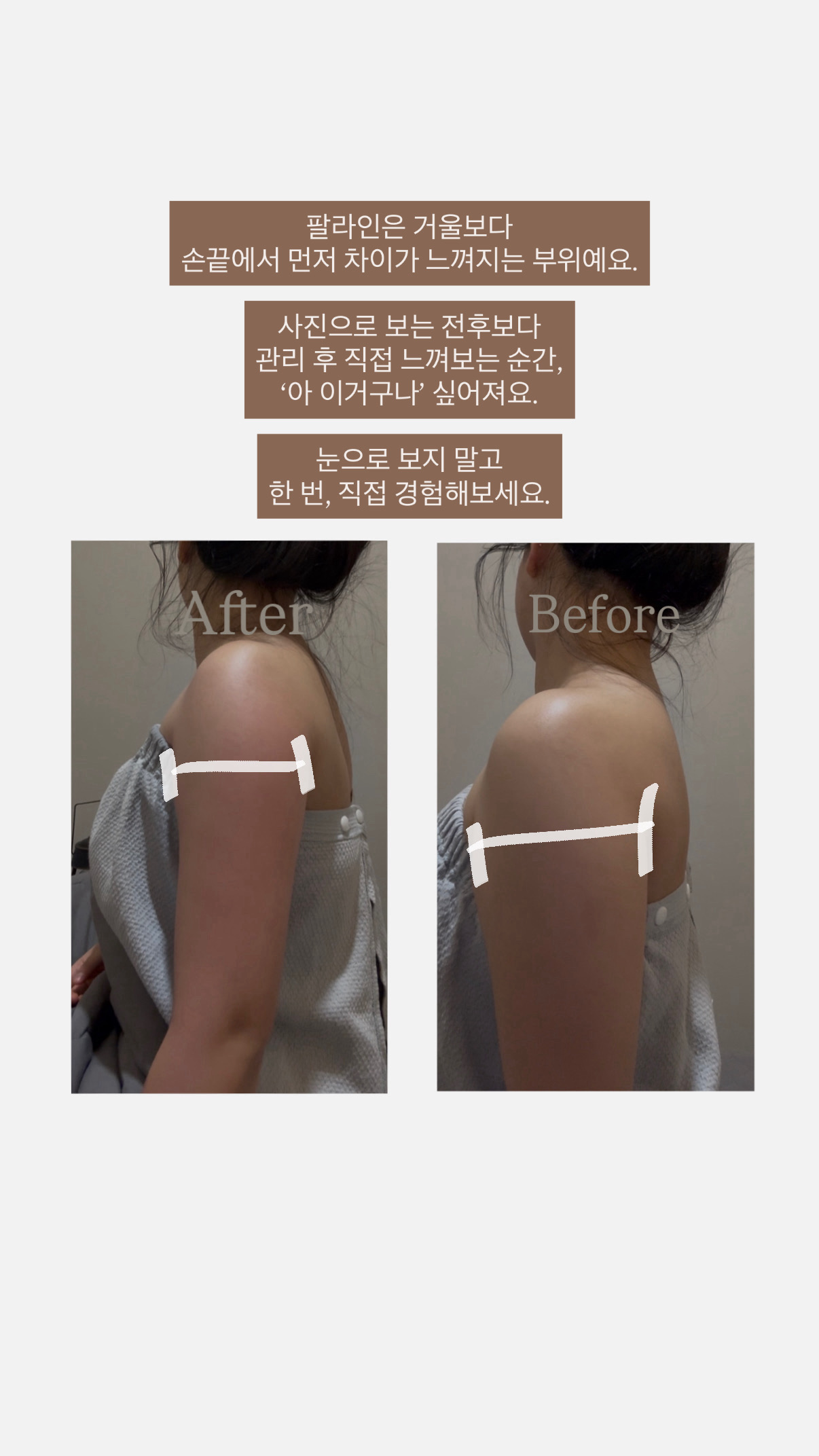 티오피에스테틱 대표 이미지