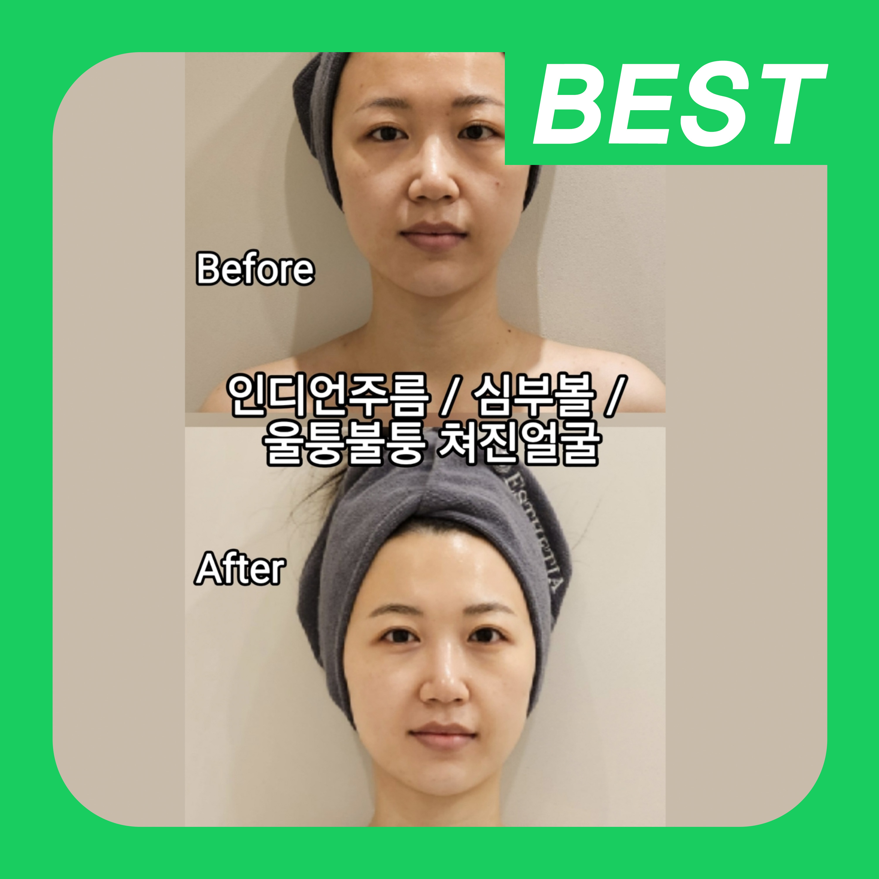 에스테티아 하남미사역점 photo 10