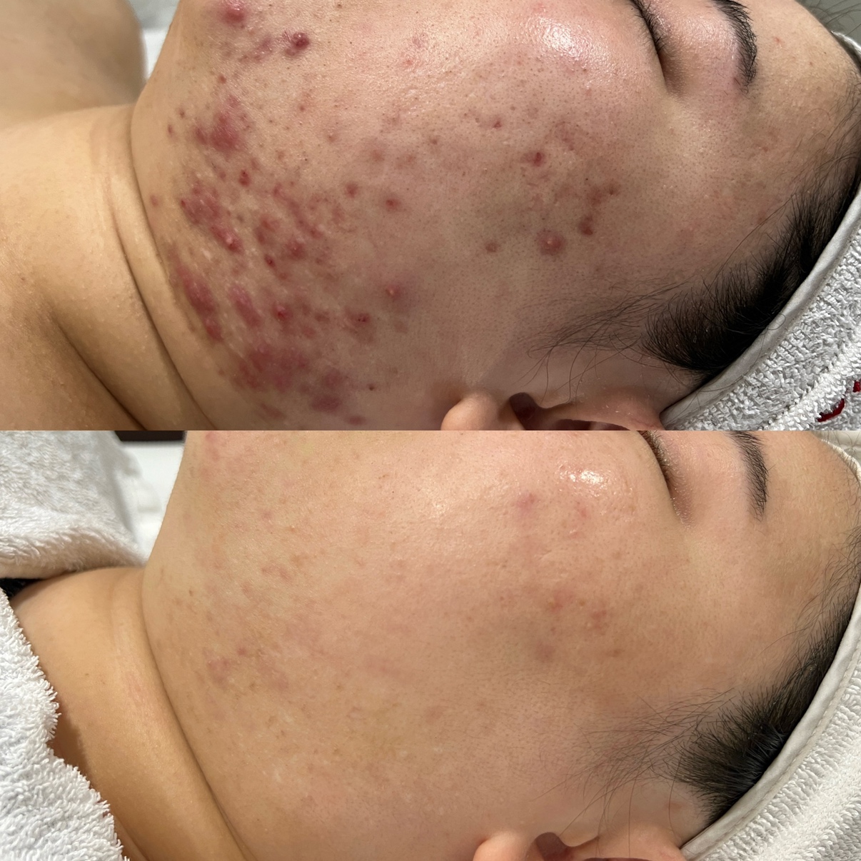 온에스테틱 압구정점 대표 이미지