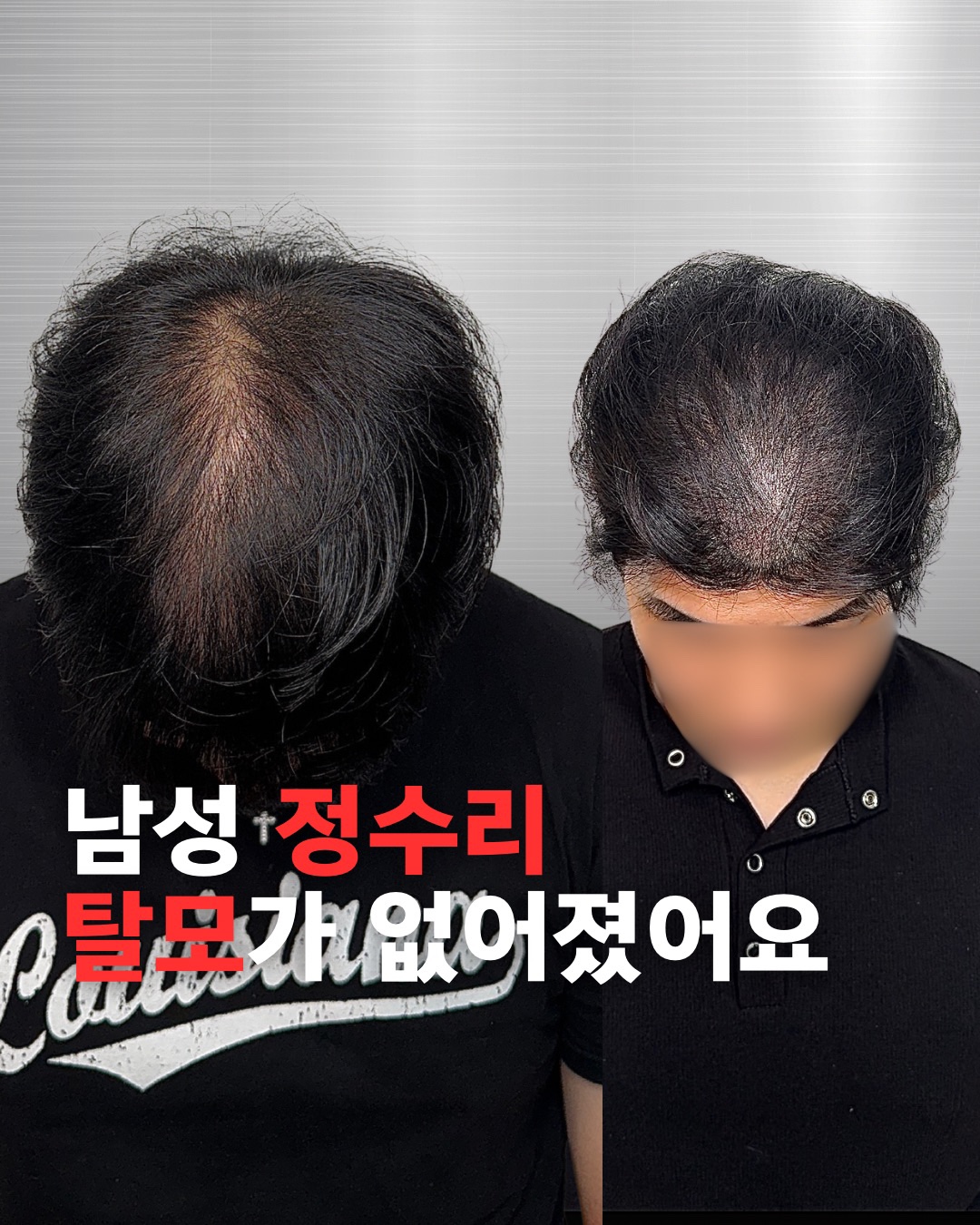 출두SMP 홍대점 대표 이미지